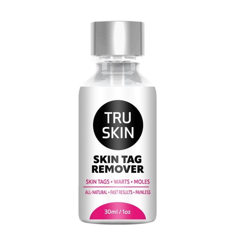 TruSkin Skin Tag Remover Reviews – Official Store!
