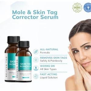 Skin Solutions Skin Tag Remover™