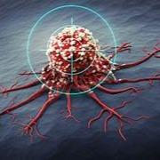 Breast Cancer Detection using Machine Learning