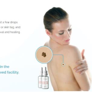 Luxe Seréna Skin Tag Remover Serum Reviews USA