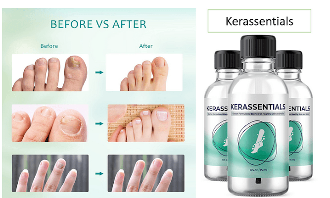 Kerassentials "Genius" (ALERT!) Is it Safe?