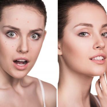 Microbio Skin Tag Remover official website