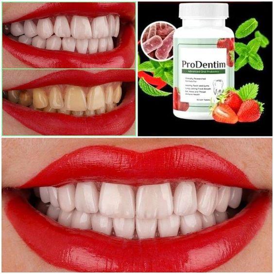 ProDentim (BE APPROVEN) It Scam Or Trusted!