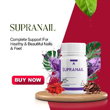 SupraNail Review: How to Achieve Perfect Nails